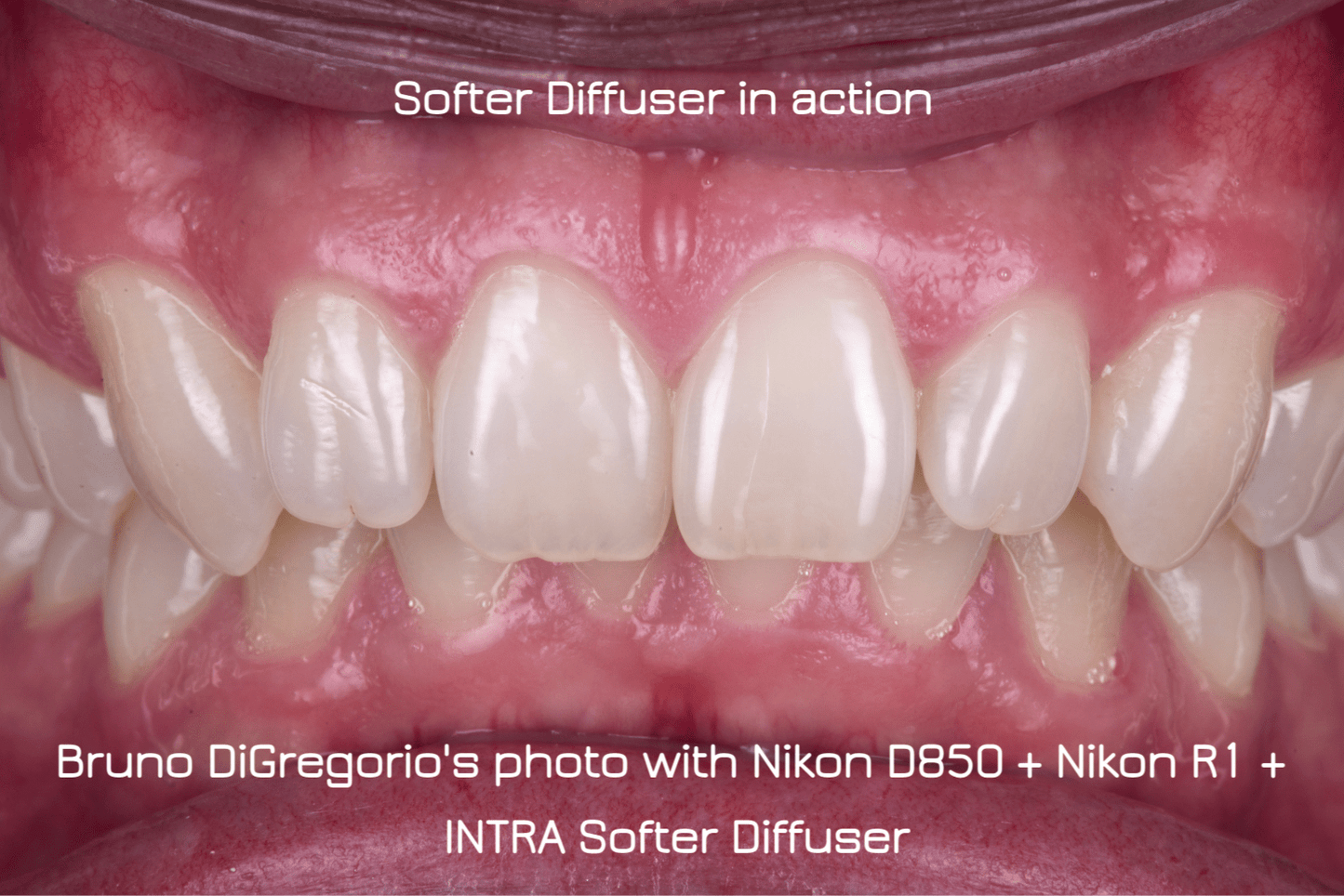 intra.diffuser kit - object photography package