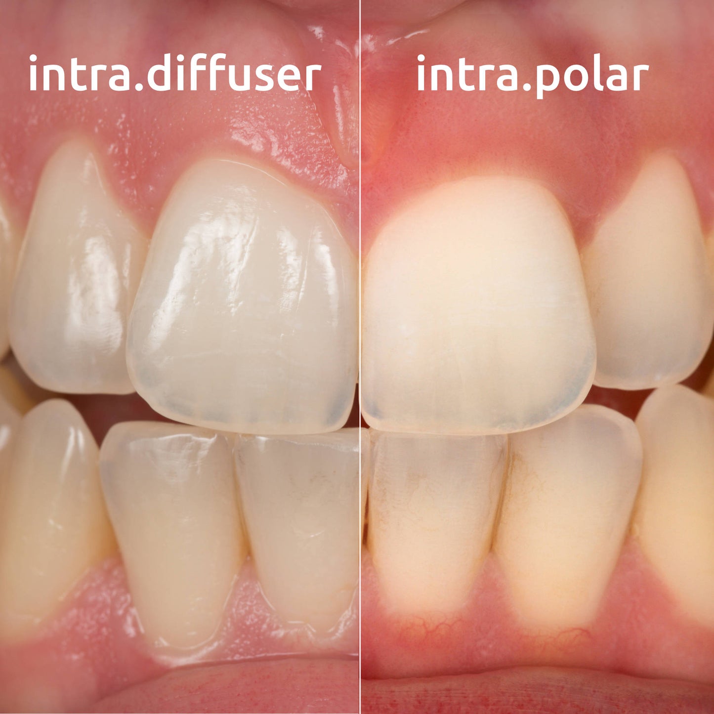 intra.polar cross-polarisation kit