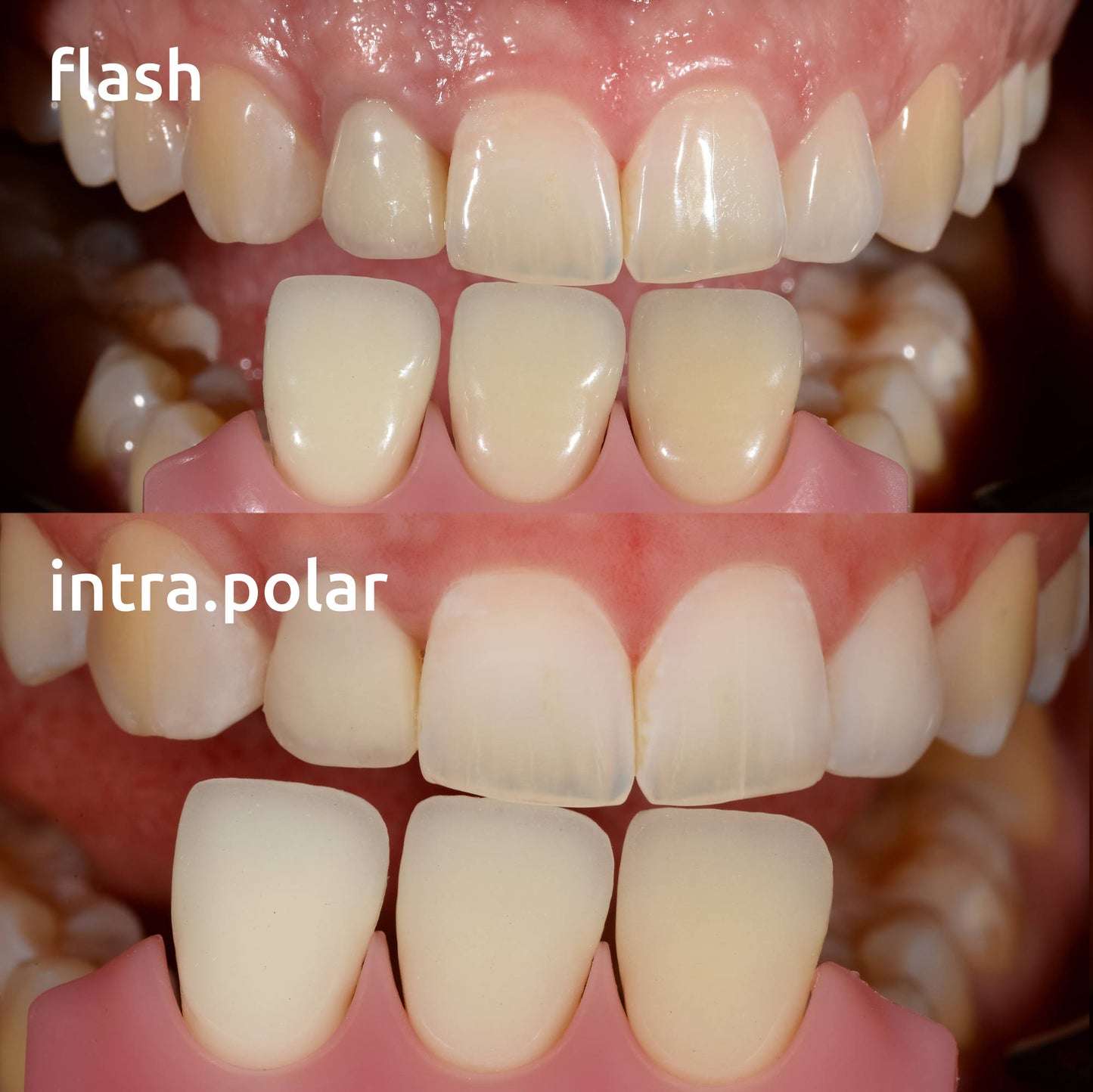 intra.polar cross-polarisation kit