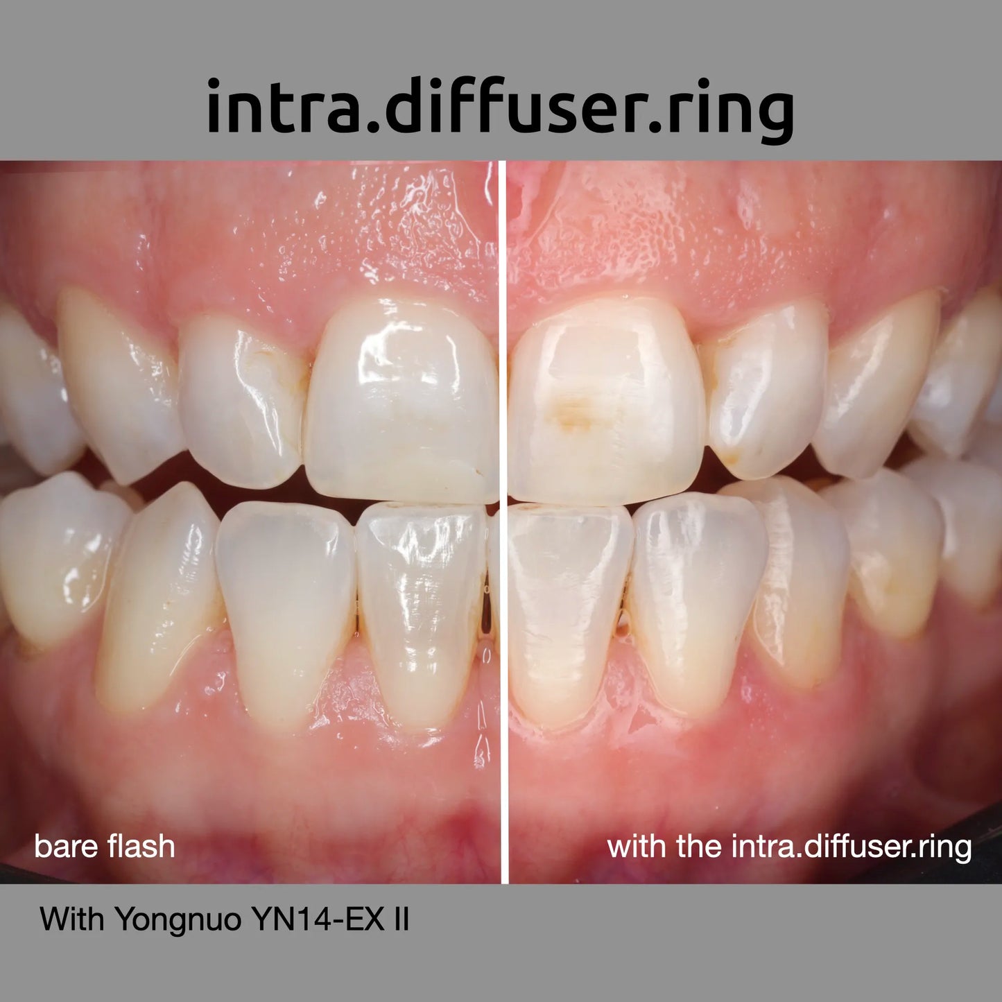 intra.diffuser.ring