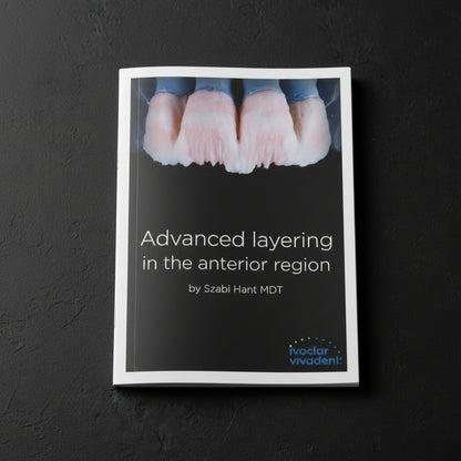 Dental crowns with text 'Advanced layering in the anterior region' by Szabi Hant MDT, Ivoclar Vivadent logo.