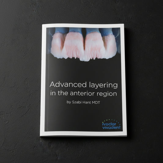 Dental crowns with text 'Advanced layering in the anterior region' by Szabi Hant MDT, Ivoclar Vivadent logo.