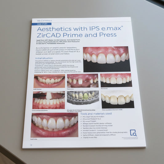 Dental case study on Aesthetics with IPS e.max ZirCAD Prime and Press, featuring before and after images of teeth.
