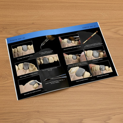 Step-by-step guide on dental wax-up process with tools and techniques.