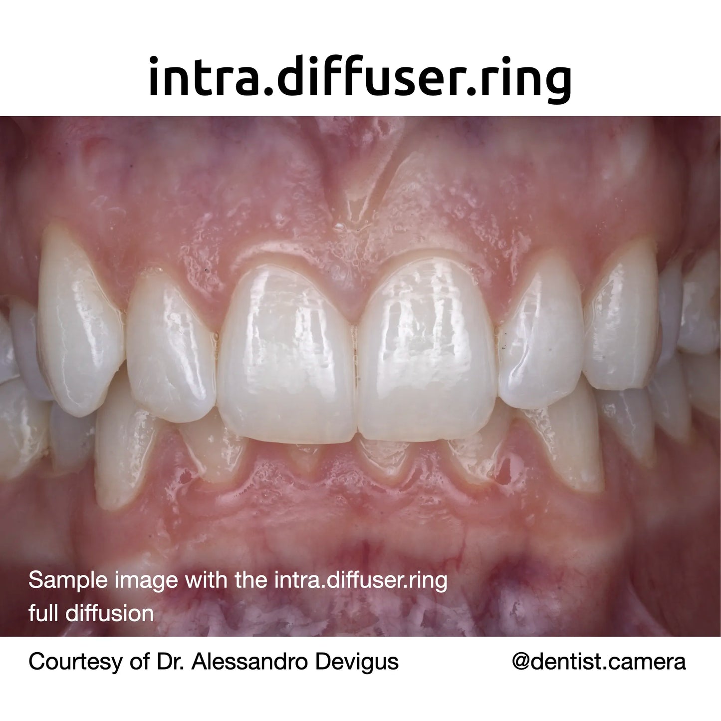 intra.diffuser kit - Flash diffuser – intra.photos